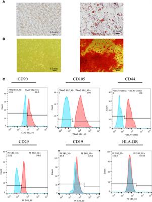 Extracellular Vesicles Inhibit Proliferation and Invasion of Ovarian Endometrial Stromal Cells and Their Expression of SF-1, ERβ, and Aromatase